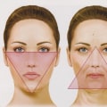 The different types of dermal fillers: a comprehensive guide