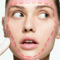 Do dermal fillers make wrinkles worse? an expert's perspective