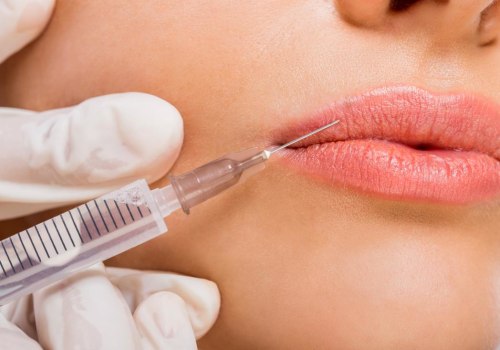 The Benefits of Dermal Fillers: A Guide to Facial Rejuvenation