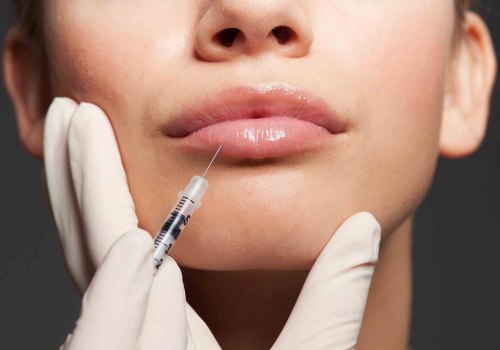 Where Do Fillers Hurt the Most? An Expert's Guide