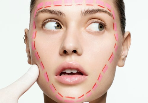 Do Dermal Fillers Make Wrinkles Worse? An Expert's Perspective