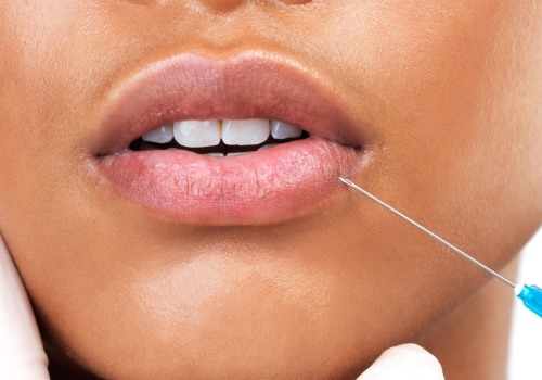 What Happens When Dermal Fillers Don't Dissolve?